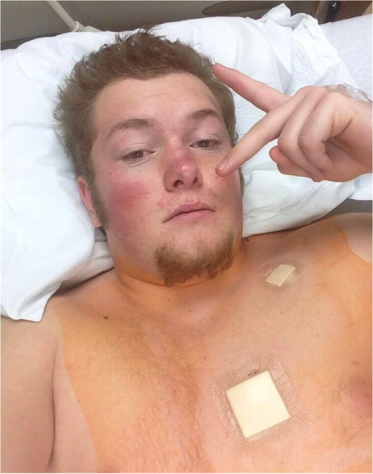 Riley Culley after undergoing surgery.